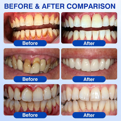 🇺🇸🏅🦷🛡️Selvitor® GumRevive Periodontal Repair Gel