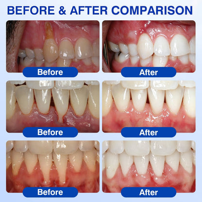 🇺🇸🏅🦷🛡️Selvitor® GumRevive Periodontal Repair Gel