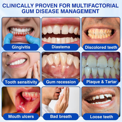 🇺🇸🏅🦷🛡️Selvitor® GumRevive Periodontal Repair Gel