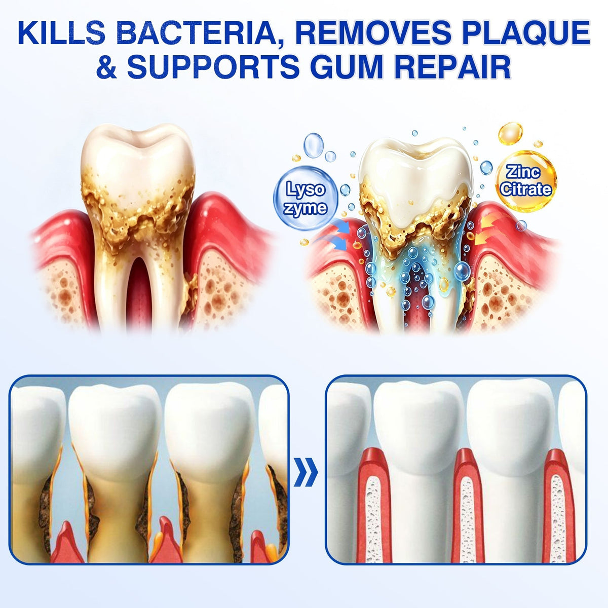 🇺🇸🏅🦷🛡️Selvitor® GumRevive Periodontal Repair Gel