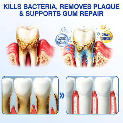 🇺🇸🏅🦷🛡️Selvitor® GumRevive Periodontal Repair Gel