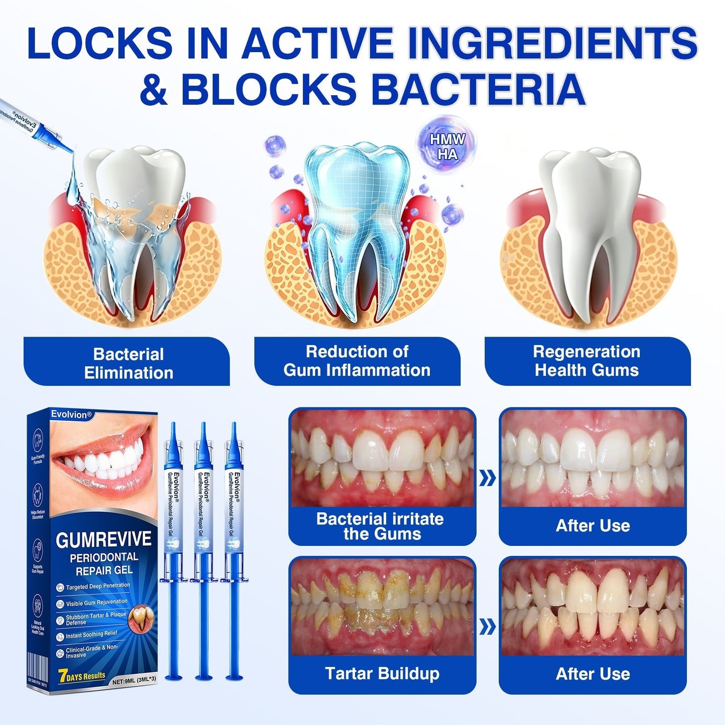 🇺🇸🏅🦷🛡️Selvitor® GumRevive Periodontal Repair Gel
