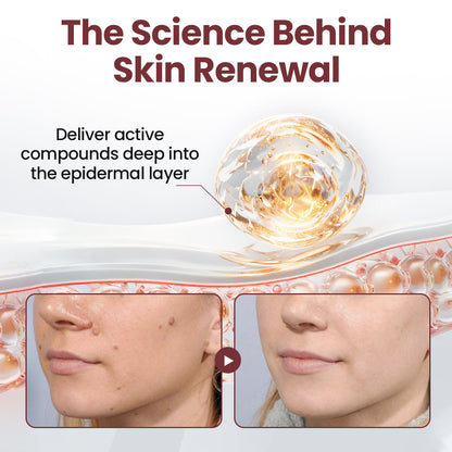 Natravor® KeraErase Dual-Action Renewal Cream