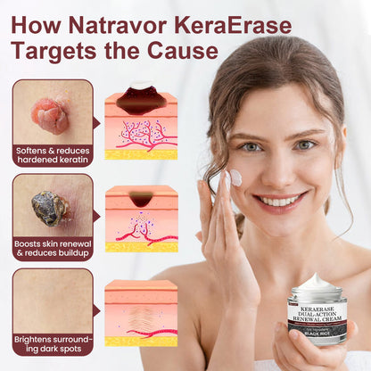 Natravor® KeraErase Dual-Action Renewal Cream