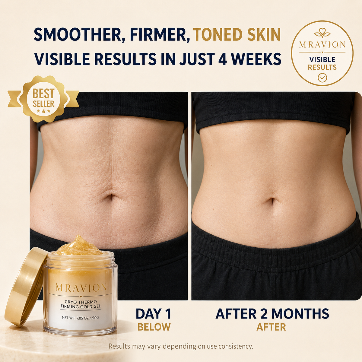 MRAVION™ Anti-Cellulite Body Cream